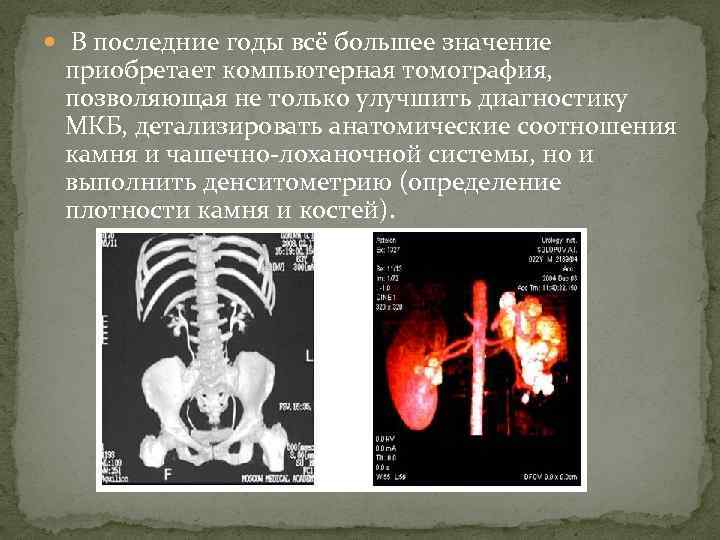  В последние годы всё большее значение приобретает компьютерная томография, позволяющая не только улучшить