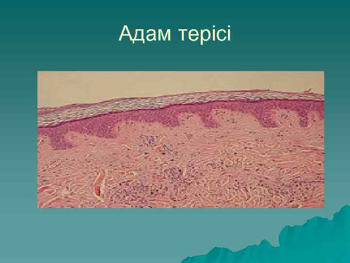 Адам терісі 