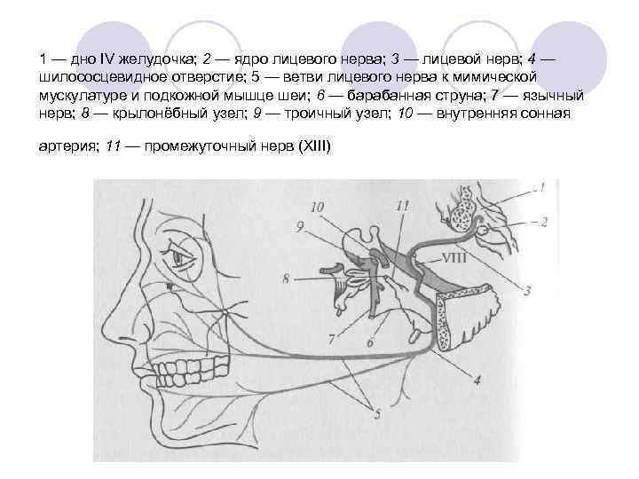 1 — дно IV желудочка; 2 — ядро лицевого нерва; 3 — лицевой нерв;