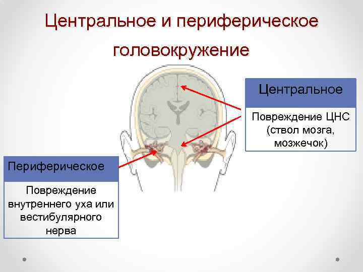 Вестибулярные ядра ствола мозга это вторичный центр