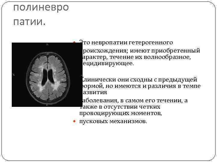 полиневро патии. Это невропатии гетерогенного происхождения; имеют приобретенный характер, течение их волнообразное, рецидивирующее. Клинически