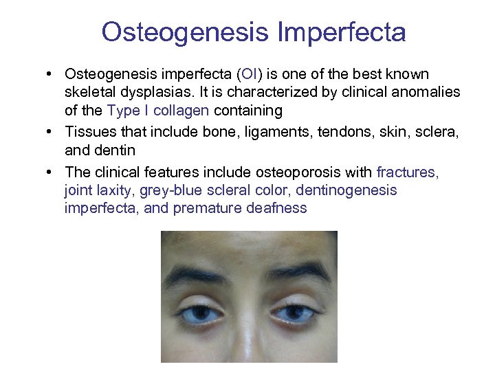 Osteogenesis Imperfecta • Osteogenesis imperfecta (OI) is one of the best known skeletal dysplasias.