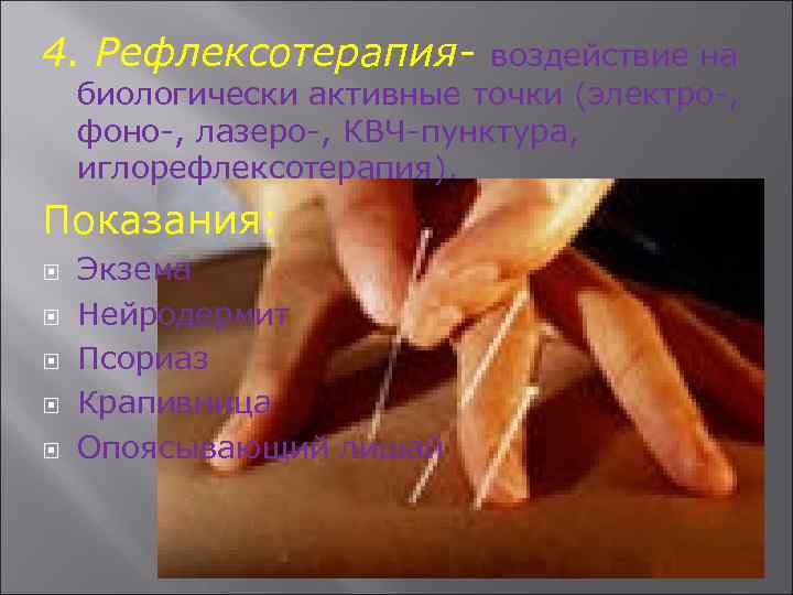 4. Рефлексотерапия- воздействие на биологически активные точки (электро-, фоно-, лазеро-, КВЧ-пунктура, иглорефлексотерапия). Показания: Экзема