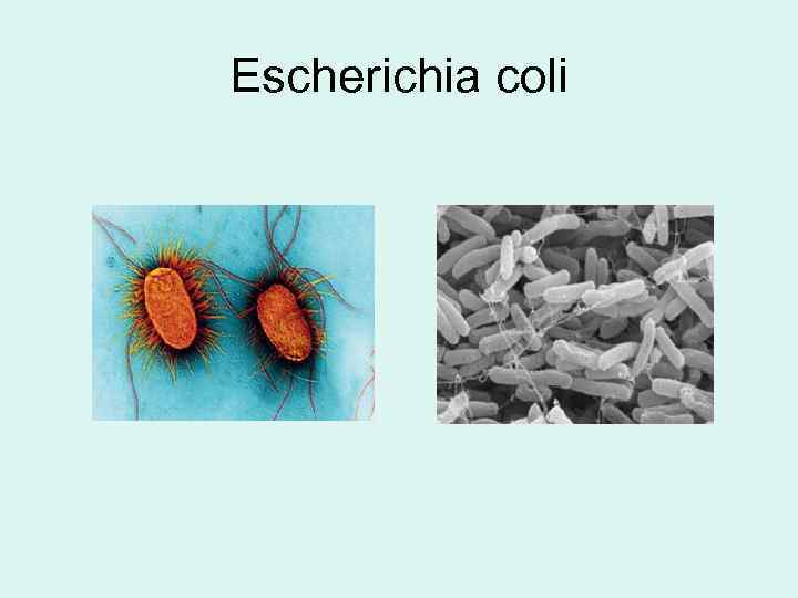 Escherichia coli 