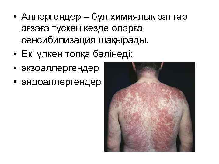  • Аллергендер – бұл химиялық заттар ағзаға түскен кезде оларға сенсибилизация шақырады. •