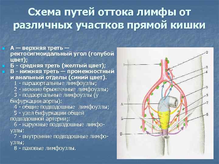 Схема путей оттока лимфы от различных участков прямой кишки n n n А —