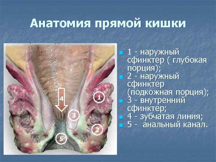 Анатомия прямой кишки n n 1 4 3 2 5 n n n 1