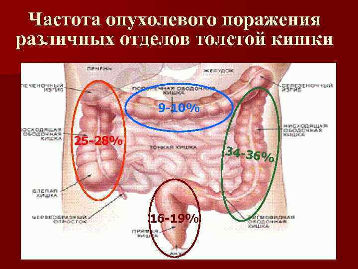 Частота опухолевого поражения различных отделов толстой кишки 9 -10% 25 -28% 34 -36% 16