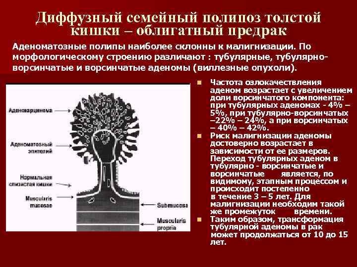Диффузный семейный полипоз толстой кишки – облигатный предрак Аденоматозные полипы наиболее склонны к малигнизации.