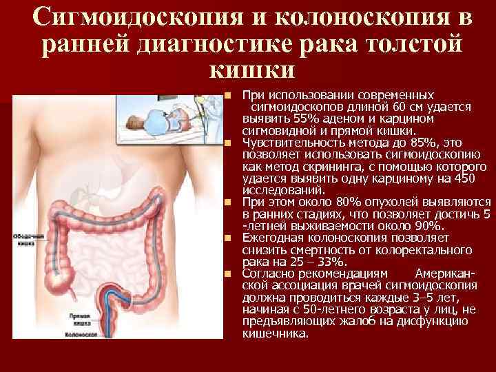 Сигмоидоскопия и колоноскопия в ранней диагностике рака толстой кишки n n n При использовании