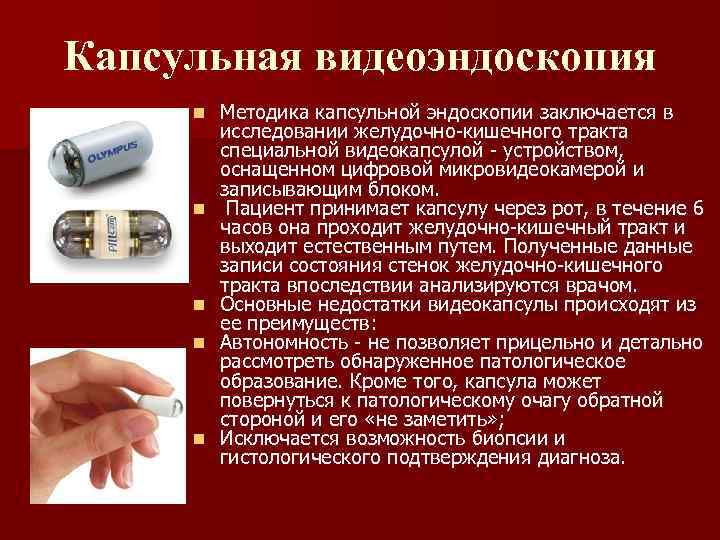 Капсульная видеоэндоскопия n n n Методика капсульной эндоскопии заключается в исследовании желудочно-кишечного тракта специальной
