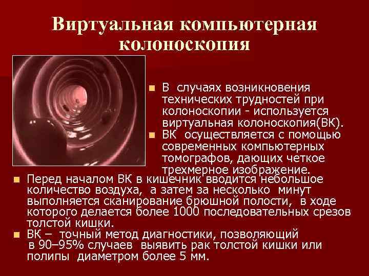 Виртуальная компьютерная колоноскопия В случаях возникновения технических трудностей при колоноскопии - используется виртуальная колоноскопия(ВК).