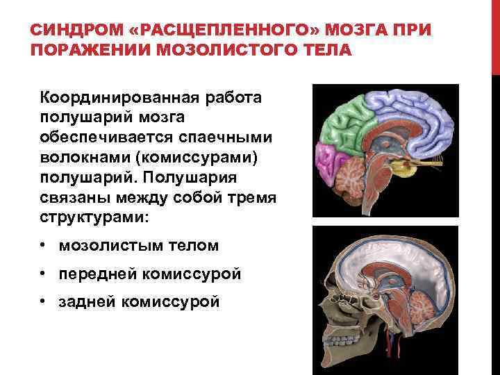 Основные понятия нейропсихологии презентация