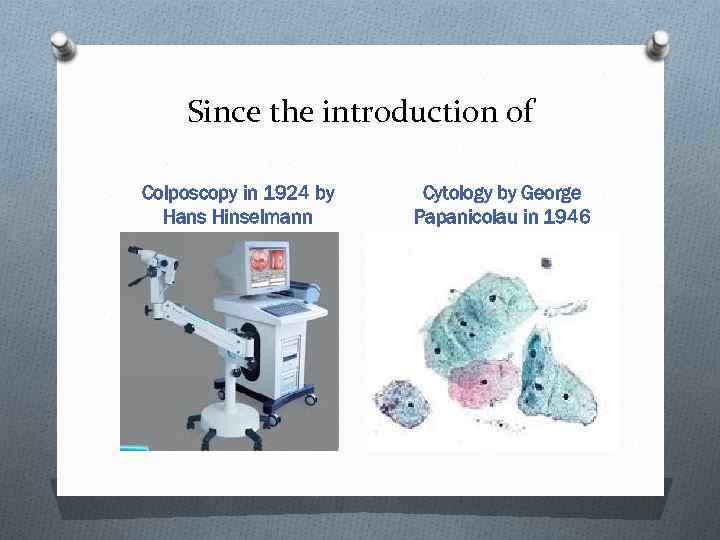 Since the introduction of Colposcopy in 1924 by Hans Hinselmann Cytology by George Papanicolau