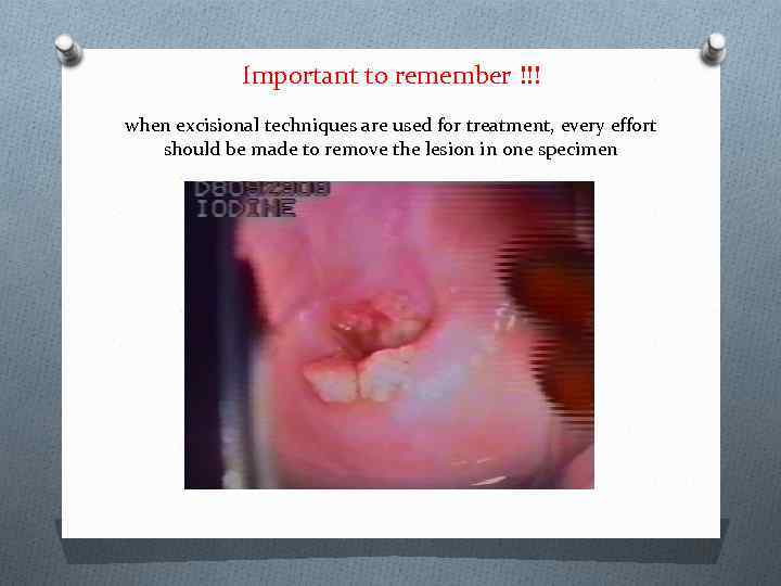 Important to remember !!! when excisional techniques are used for treatment, every effort should