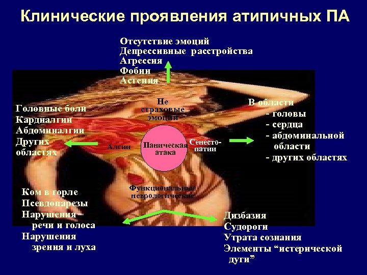 Клинические проявления атипичных ПА Отсутствие эмоций Депрессивные расстройства Агрессия Фобии Астения Головные боли Кардиалгии