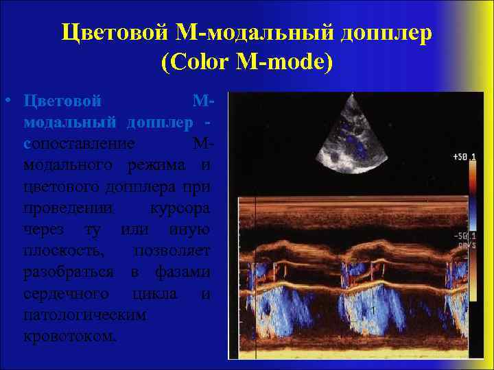 Цветовой M-модальный допплер (Color M-mode) • Цветовой Mмодальный допплер сопоставление Mмодального режима и цветового