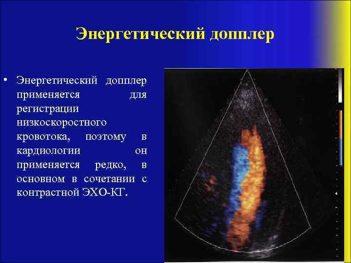 Энергетический допплер • Энергетический допплер применяется для регистрации низкоскоростного кровотока, поэтому в кардиологии он