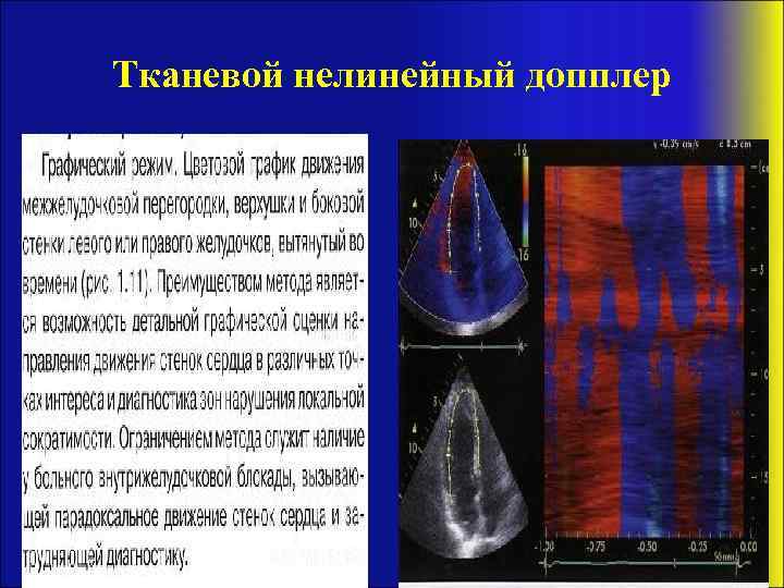 Тканевой нелинейный допплер 