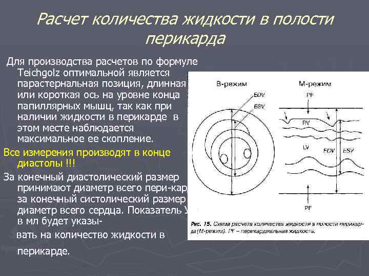 Расчет количества жидкости в полости перикарда Для производства расчетов по формуле Teichgolz оптимальной является