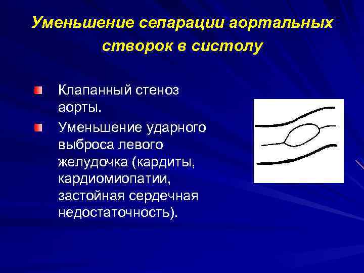 Уменьшение сепарации аортальных створок в систолу Клапанный стеноз аорты. Уменьшение ударного выброса левого желудочка
