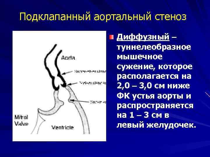 Двустворчатый аортальный клапан симптомы