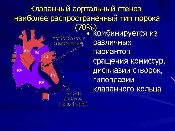 Клапан легочной артерии норма