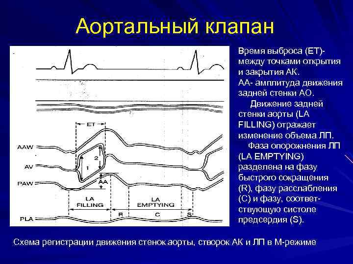 Что такое аортальный клапан