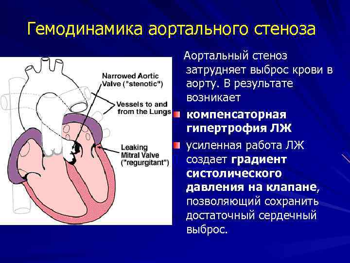 Аортальный клапан на узи