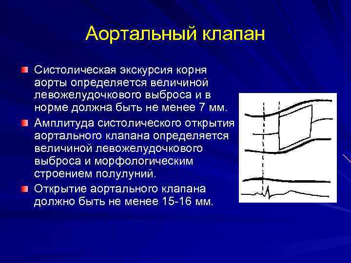 Легочный и аортальный клапан