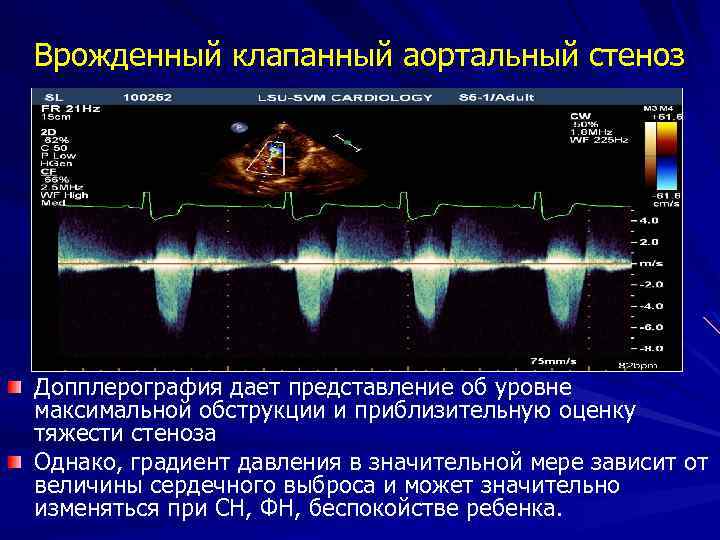 Аортальный клапан нормальные показатели