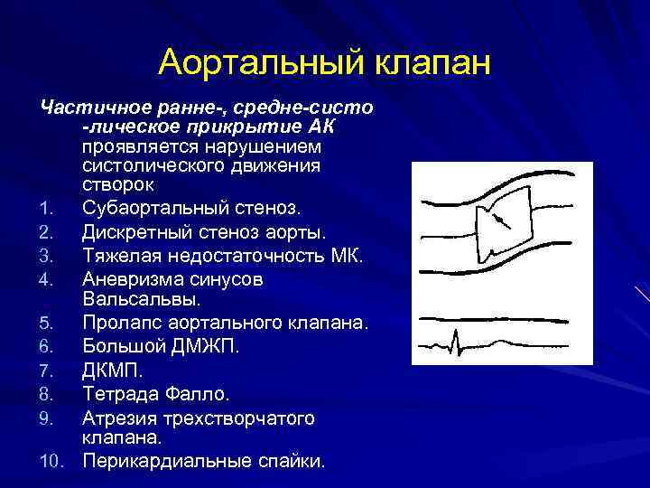 Аортальный клапан нормальные показатели