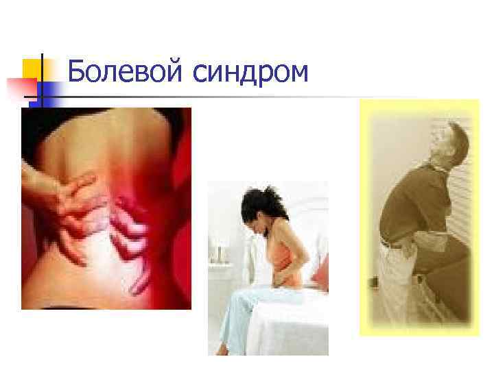 Болевой синдром 