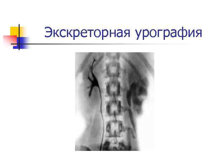 Экскреторная урография рентгенологическое исследование почек относится к функциональным изображениям