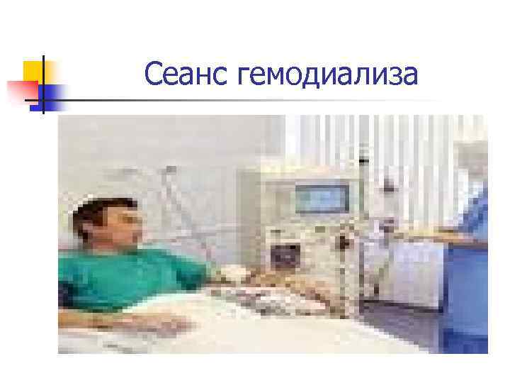 Сеанс гемодиализа 