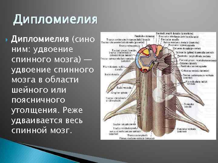 Дипломиелия (сино ним: удвоение спинного мозга) — удвоение спинного мозга в области шейного или