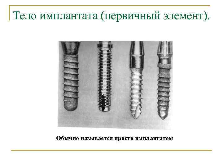 Тело имплантата (первичный элемент). Обычно называется просто имплантатом 