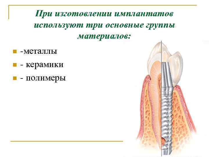 При изготовлении имплантатов используют три основные группы материалов: n n n -металлы - керамики