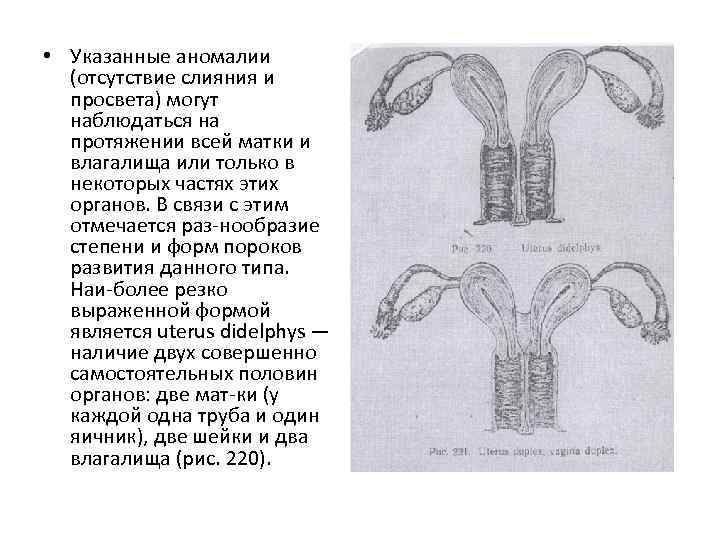  • Указанные аномалии (отсутствие слияния и просвета) могут наблюдаться на протяжении всей матки