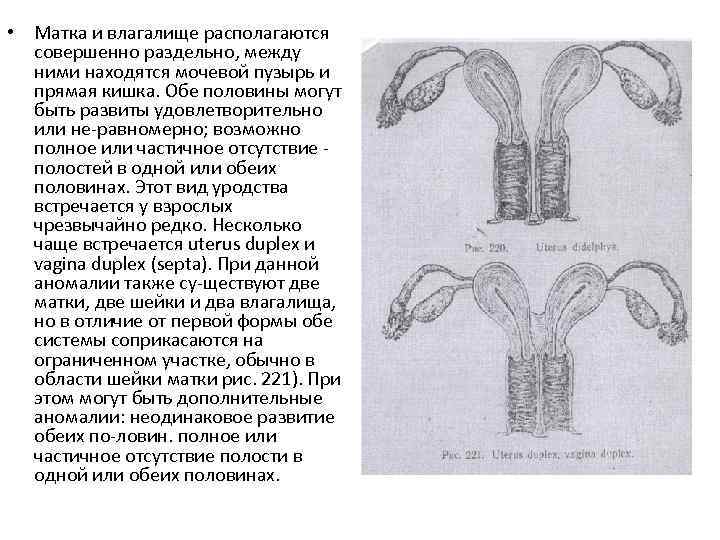  • Матка и влагалище располагаются совершенно раздельно, между ними находятся мочевой пузырь и