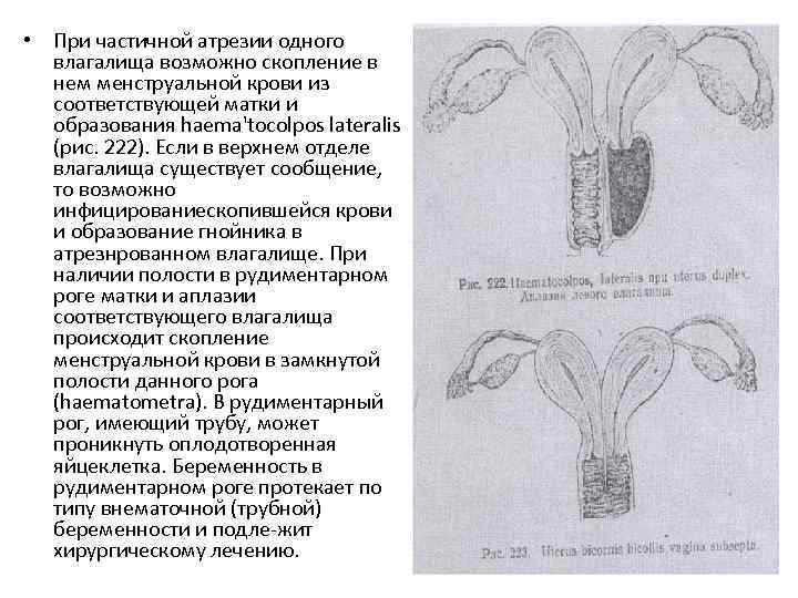  • При частичной атрезии одного влагалища возможно скопление в нем менструальной крови из
