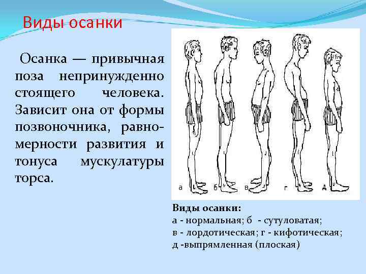  Виды осанки Осанка — привычная поза непринужденно стоящего человека. Зависит она от формы