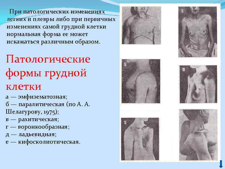  При патологических изменениях легких и плевры либо при первичных изменениях самой грудной клетки