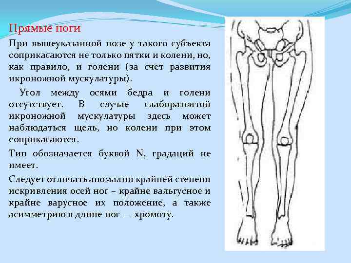 Прямые ноги При вышеуказанной позе у такого субъекта соприкасаются не только пятки и колени,