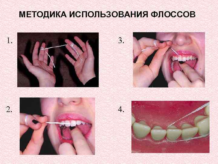 МЕТОДИКА ИСПОЛЬЗОВАНИЯ ФЛОССОВ 1. 3. 2. 4. 