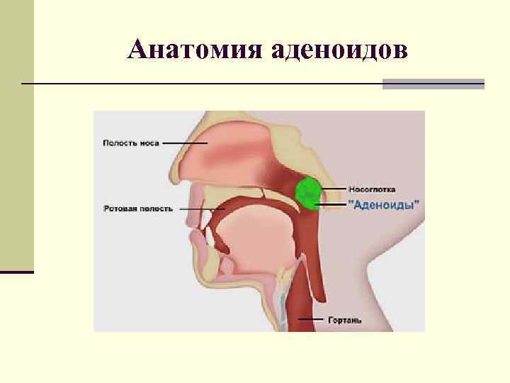 Анатомия аденоидов 