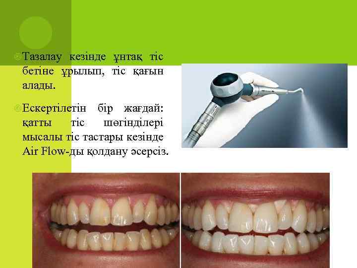 Тазалау кезінде ұнтақ тіс бетіне ұрылып, тіс қағын алады. Ескертілетін бір жағдай: қатты