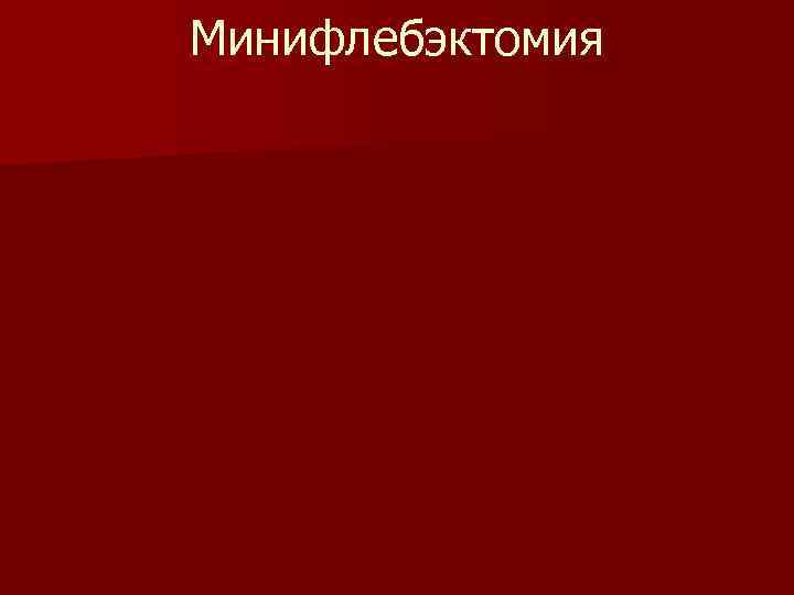 Минифлебэктомия 