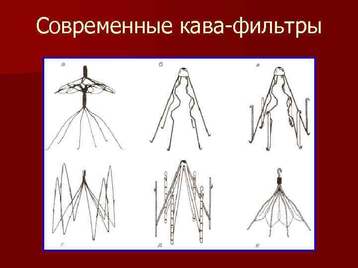 Современные кава-фильтры 