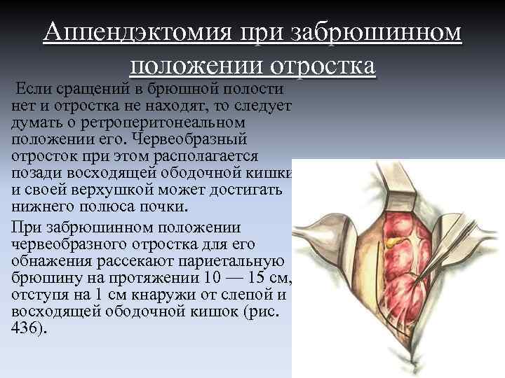 При положении фаулера изголовье кровати поднимают под углом